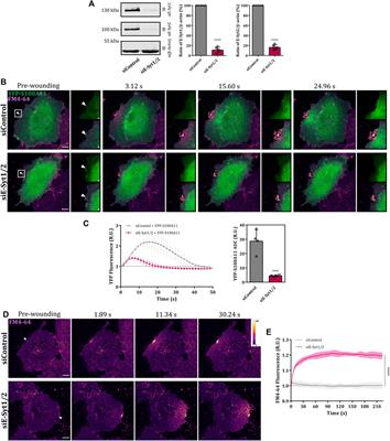 The resealing factor S100A11 interacts with annexins and extended synaptotagmin-1 in the course of plasma membrane wound repair